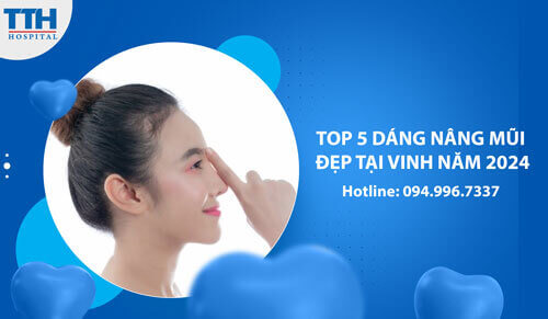 Top 5 Dáng Nâng Mũi Đẹp Tại Vinh năm 2024